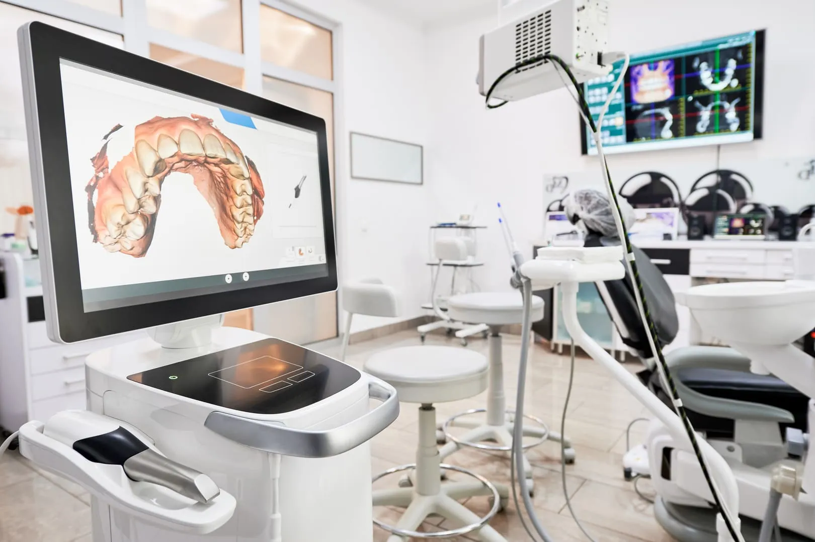Intra-Oral Scanners (iTero)
