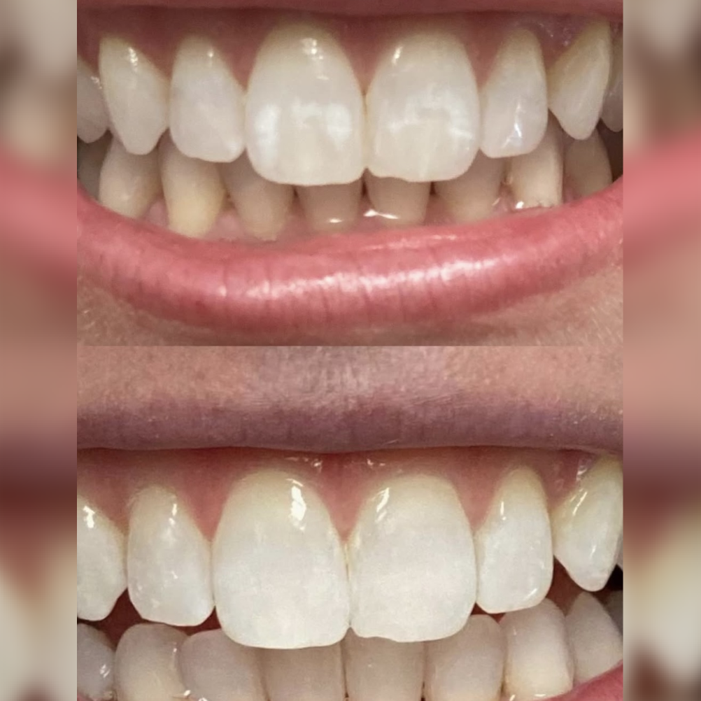 Icon Resin Treatments